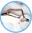 Clean and floss orthodontic appliances