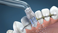 Plaque Seeker tip with retainer