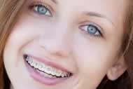 Teens with braces