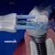 Using WPS-2E Whitening Plaque Seeker™ Tips