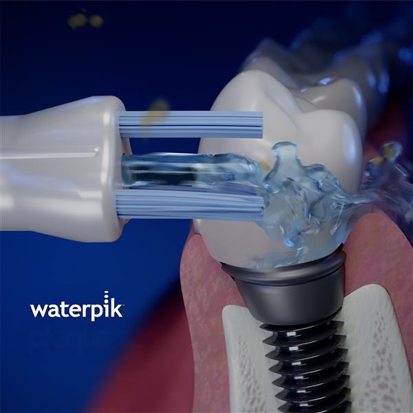 Using WPS-2E Whitening Plaque Seeker™ Tips
