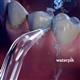 Utilisation de embout Blanchiment Precision (Classique)