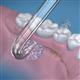 Utilisation de Embout pour Prothèse Dentaire Arc Bas DT-100E