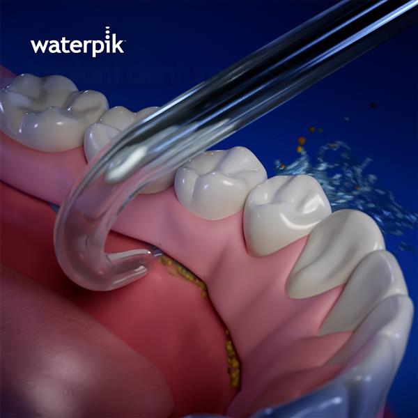 Utilisation de Embout pour Prothèse Dentaire Arc Bas DT-100E